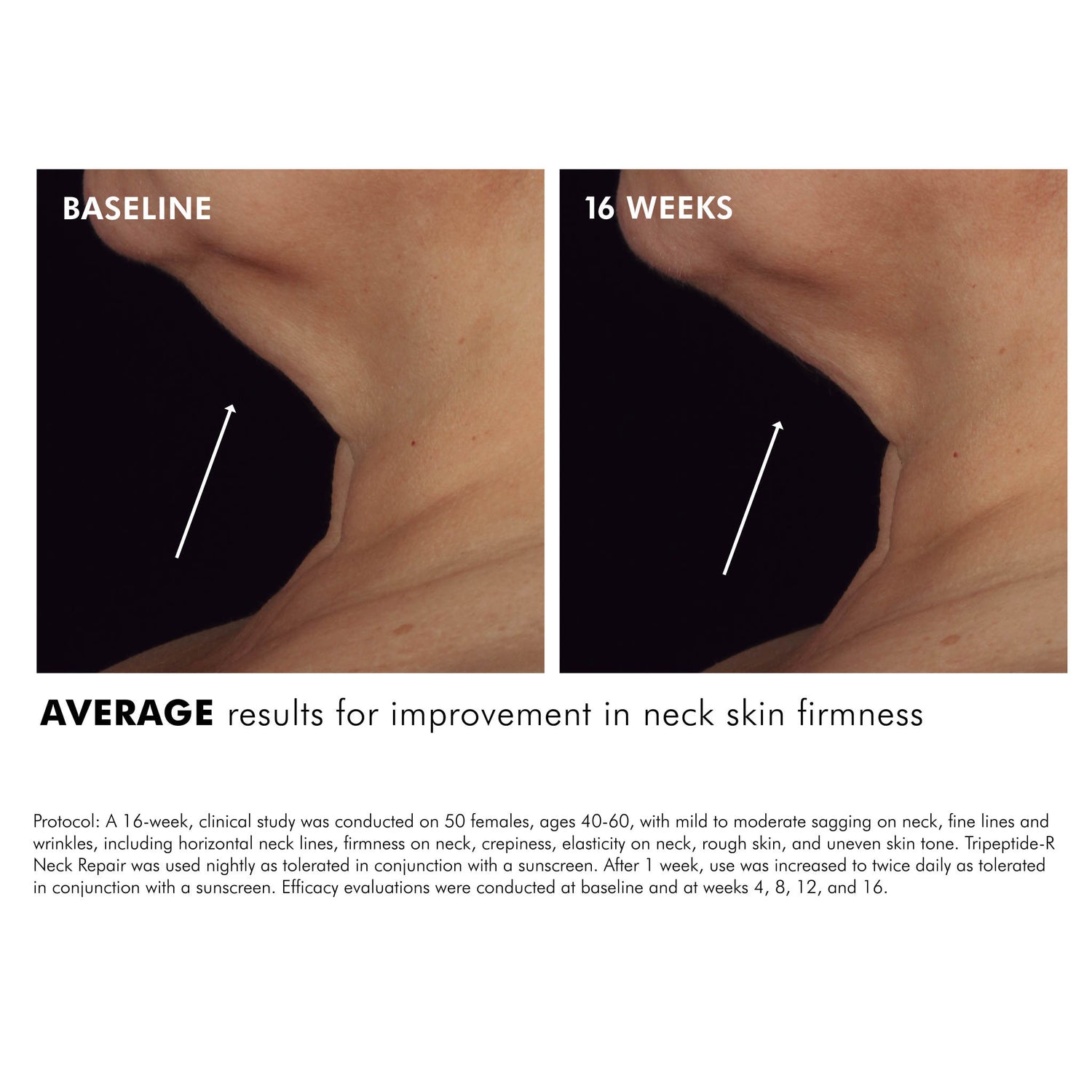 SkinCeuticals Tripeptide-R Neck Repair before and after image 2 .