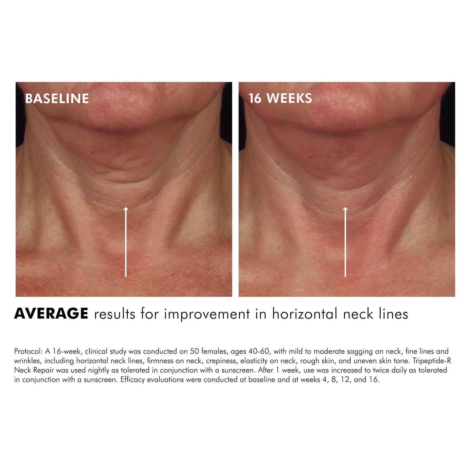 SkinCeuticals Tripeptide-R Neck Repair before and after image 3 .