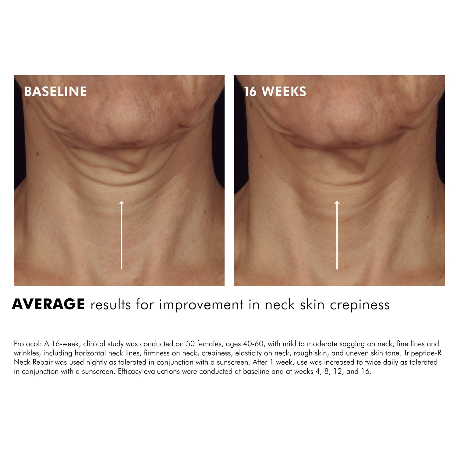 Before and after results of using SkinCeuticals Tripeptide-R Neck Repair