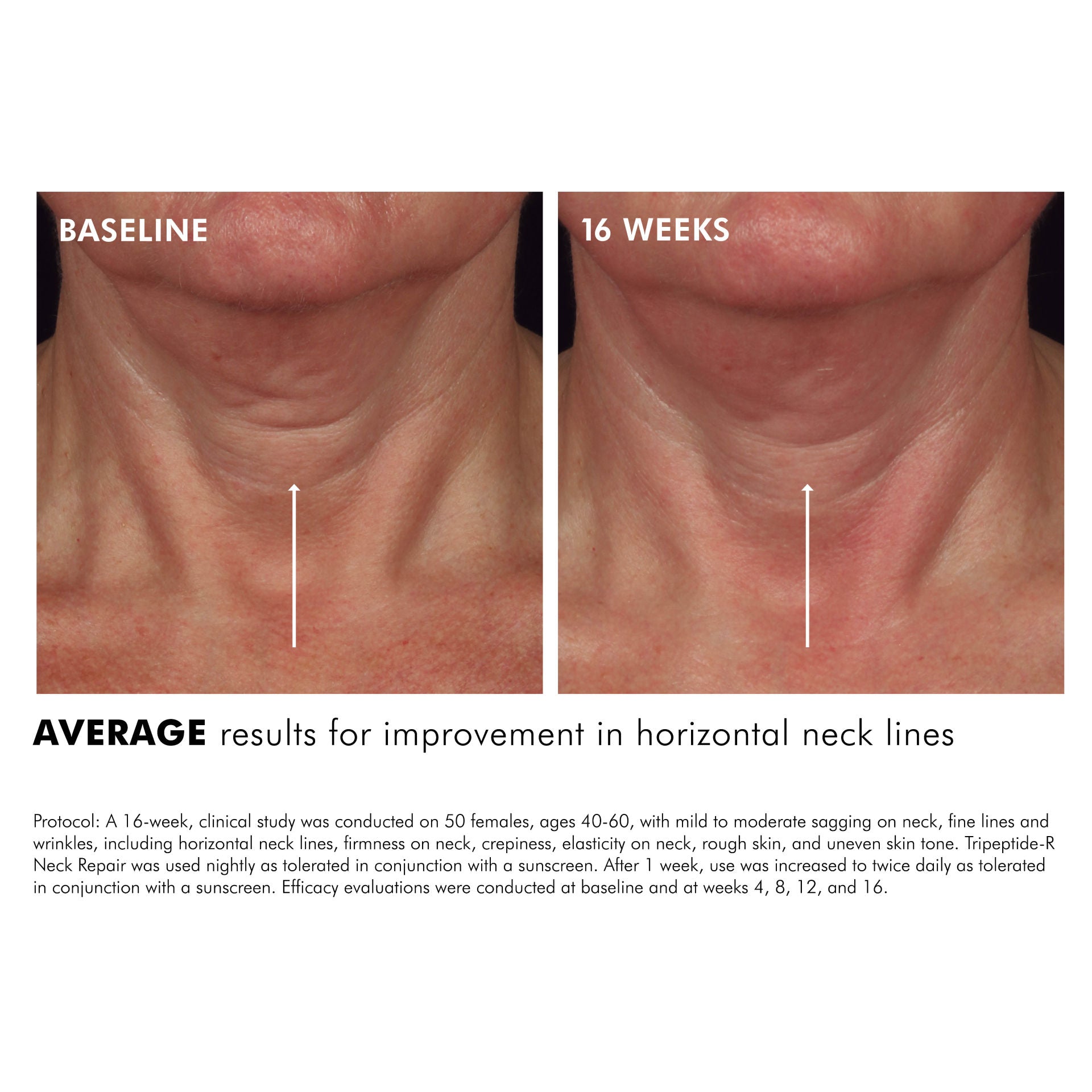 Skinceuticals offers Tripeptide Neck + Age Eye Complex