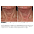 Before and after results of using SkinCeuticals Tripeptide-R Neck Repair