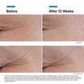 Before and after results of using SkinCeuticals P-TIOX