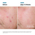 Before and after results of using SkinCeuticals Advanced RGN-6 Regenerative Cream