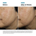Image of product in the same collection as SkinCeuticals A.G.E. Interrupter Ultra Lifting Serum