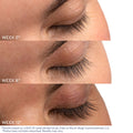 Before and after results of using Obagi Nu-Cil Eyelash Enhancing Serum