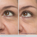 Before and after results of using Obagi Daily Hydro-Drops Rejuvenating Eye Gel Cream