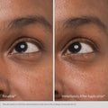 Before and after results of using Obagi Daily Hydro-Drops Rejuvenating Eye Gel Cream