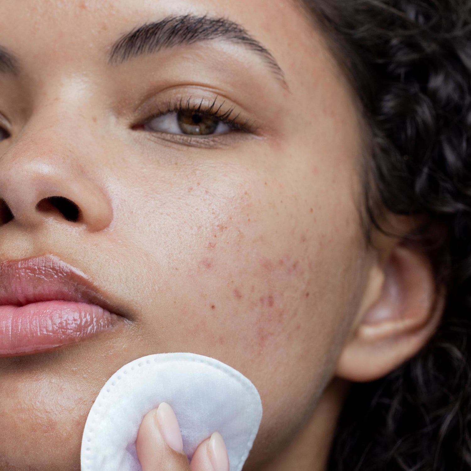 Obagi Clenziderm M.D. Pore Therapy model image .