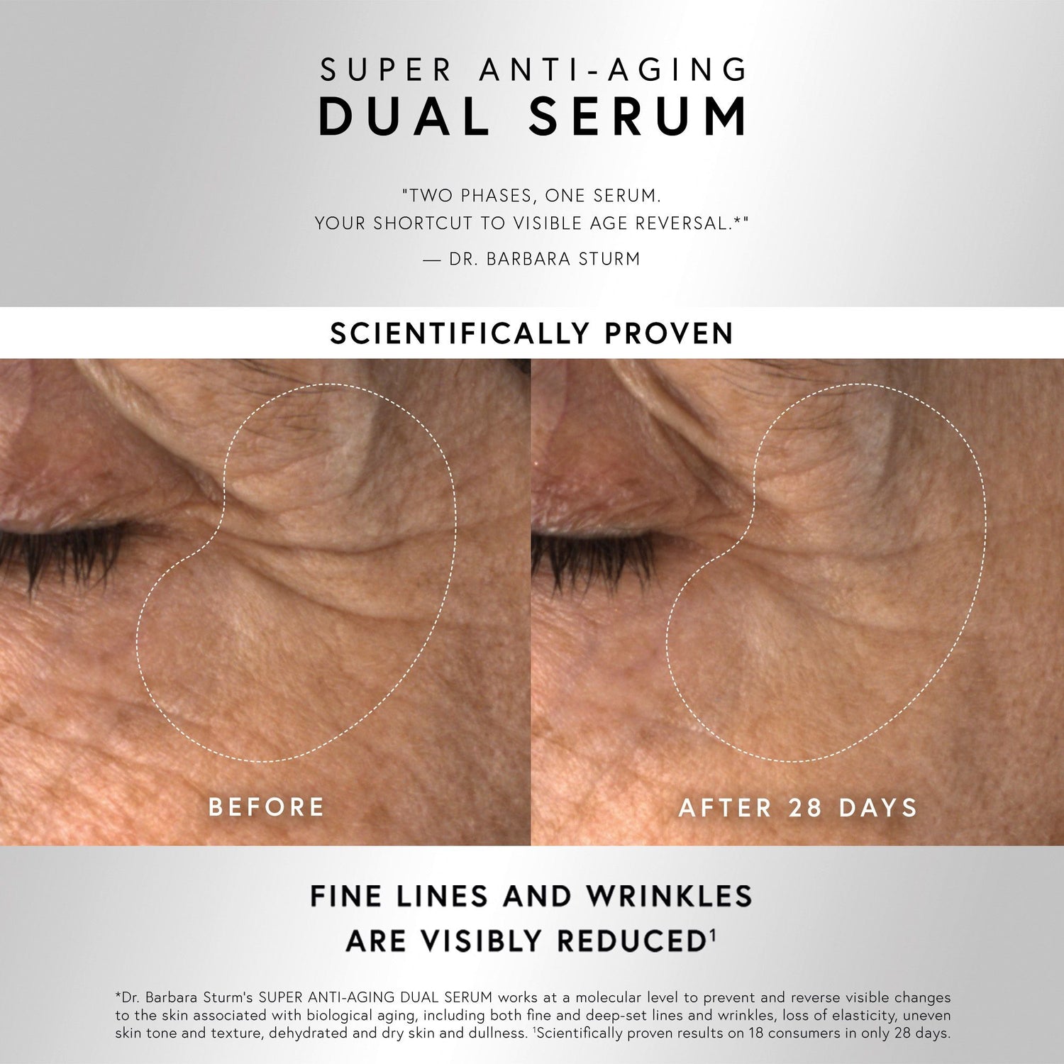 Before and after results of using Dr. Barbara Sturm Super Anti-Aging Dual Serum