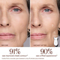 Before and after results of using NuFace TRINITY+ Starter Kit | Lift & Tighten Facial Microcurrent Device