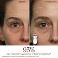 Before and after results of using NuFace TRINITY+ Starter Kit | Lift & Tighten Facial Microcurrent Device