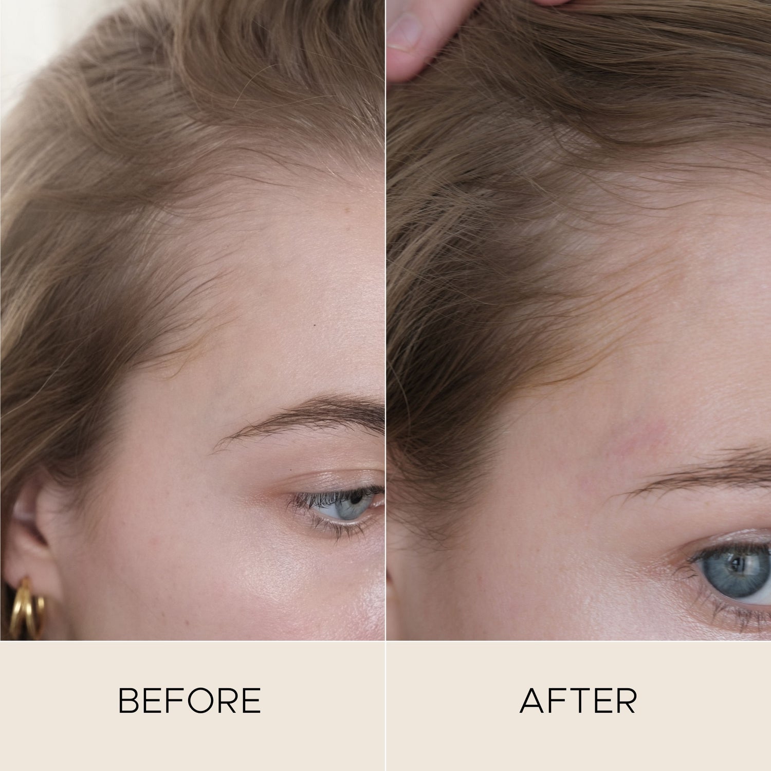 Before and after results of using Christophe Robin Fortifying Scalp Serum with Amaranth Peptides