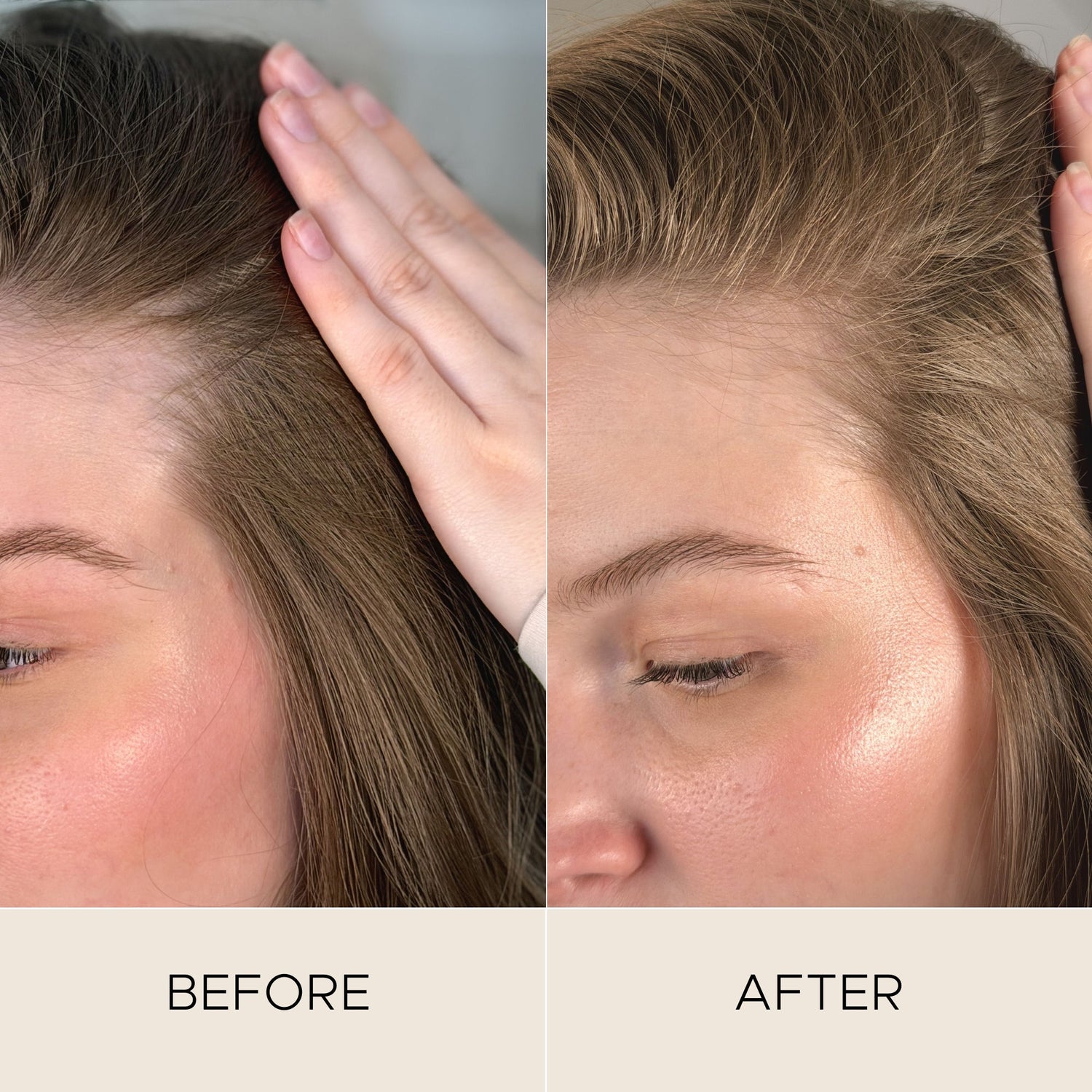 Before and after results of using Christophe Robin Fortifying Scalp Serum with Amaranth Peptides