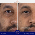 Before and after results of using Augustinus Bader The Serum Nomad