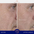 Before and after results of using Augustinus Bader The Serum Nomad