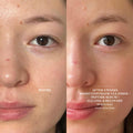 Before and after results of using The Light Salon Hydrating Peptide Serum