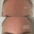 Before and after results of using The Light Salon Hydrating Peptide Serum