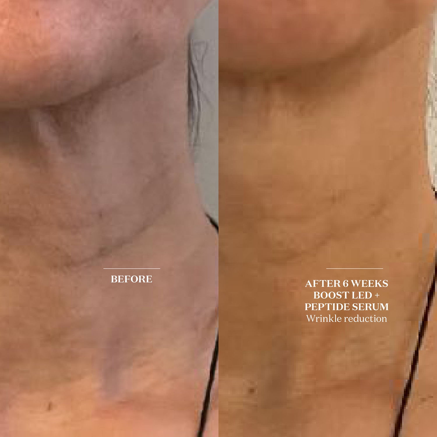 Before and after results of using The Light Salon Hydrating Peptide Serum