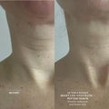 Before and after results of using The Light Salon Hydrating Peptide Serum