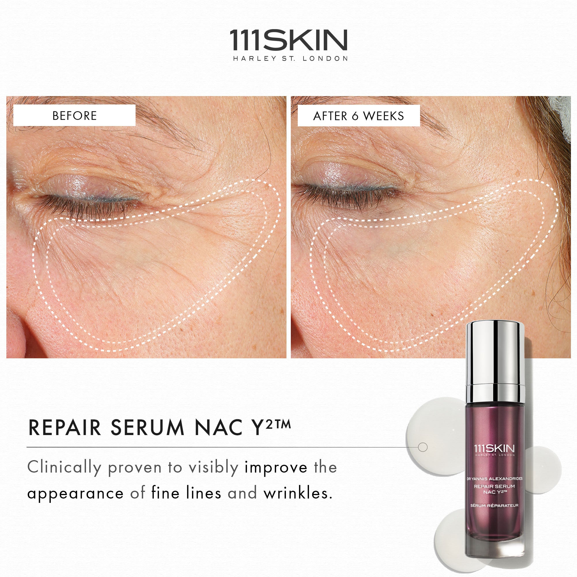 111SKIN Repair Serum NAC Y2 – 111SKIN – bluemercury
