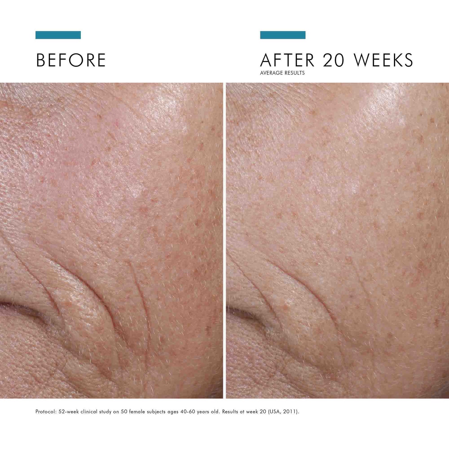 Image of product in the same collection as SkinCeuticals C E Ferulic