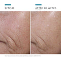 Before and after results of using SkinCeuticals C E Ferulic