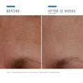 SkinCeuticals A.G.E. Interrupter before and after image .