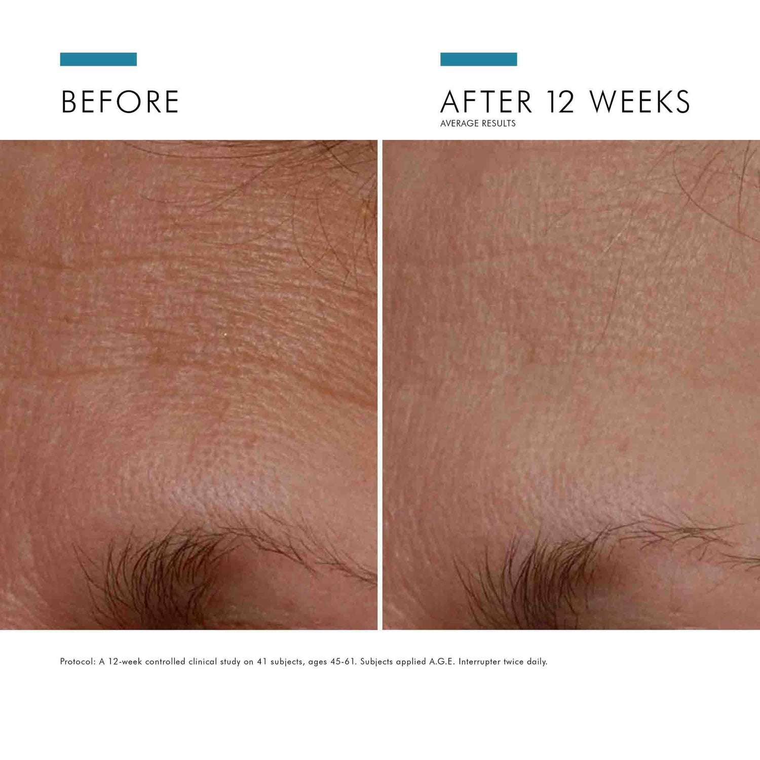 SkinCeuticals A.G.E. Interrupter before and after image .