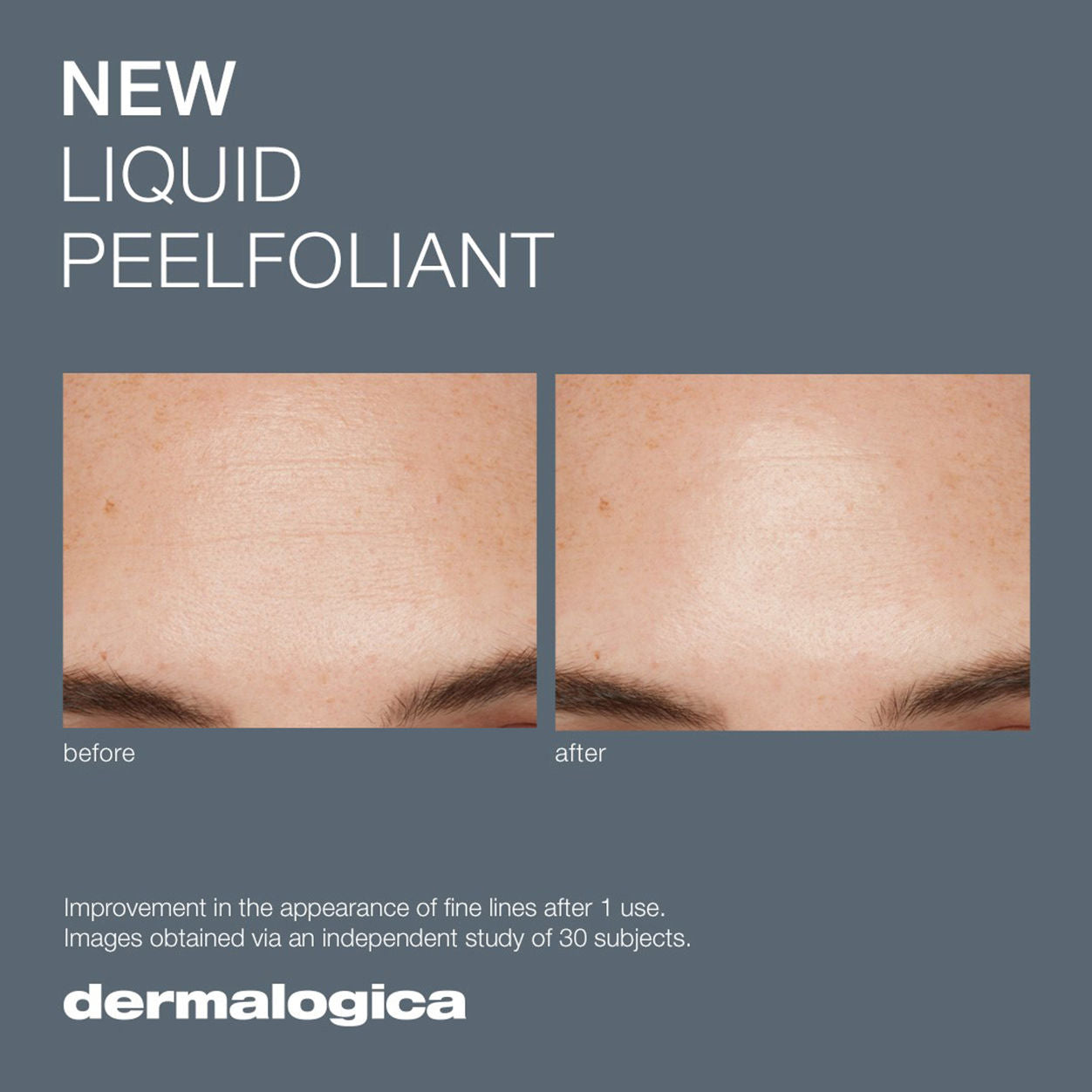 Before and after results of using Dermalogica Liquid Peelfoliant