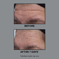 Before and after results of using Peter Thomas Roth FIRMx Collagen Serum