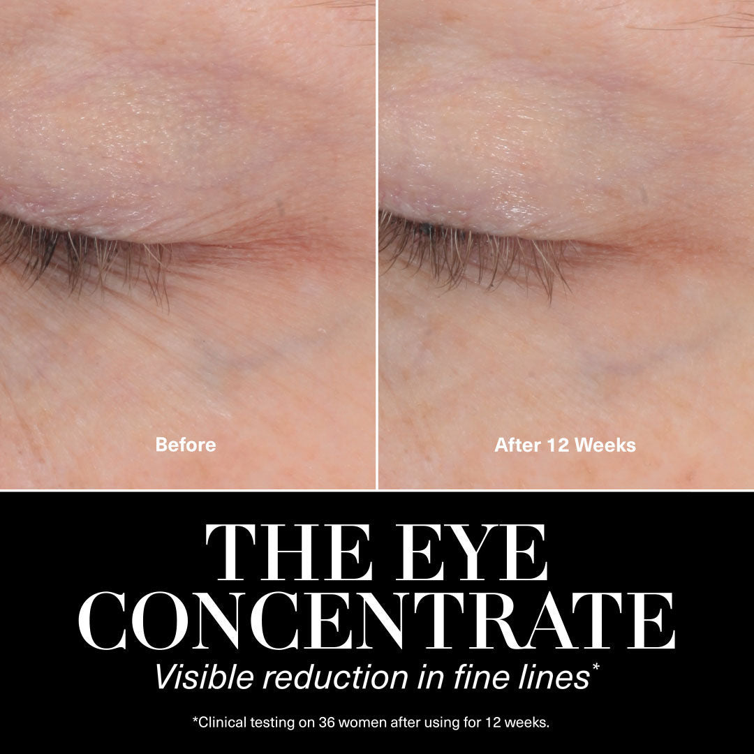 Before and after results of using La Mer The Eye Concentrate