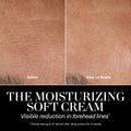 Before and after results of using La Mer The Moisturizing Soft Cream Duet (Limited Edition)