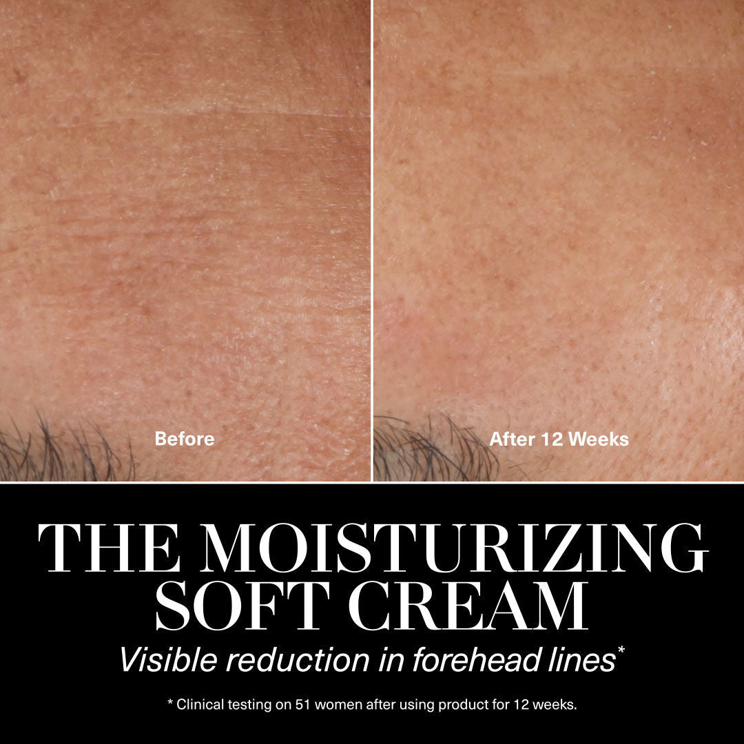 Before and after results of using La Mer The Moisturizing Soft Cream Duet (Limited Edition)