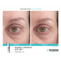 Before and after results of using Jan Marini Marini Luminate Eye Gel