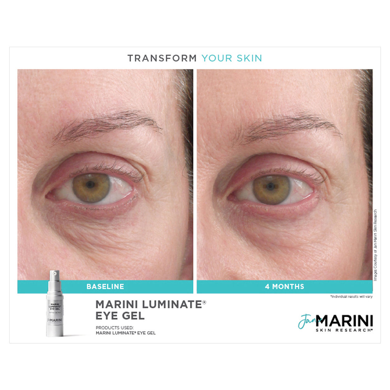 Before and after results of using Jan Marini Marini Luminate Eye Gel