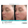 Before and after results of using Jan Marini Marini Luminate Face Lotion