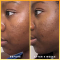 Before and after results of using Supergoop! Daily Dose Vitamin C SPF 40