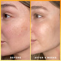 Before and after results of using Supergoop! Daily Dose Vitamin C SPF 40