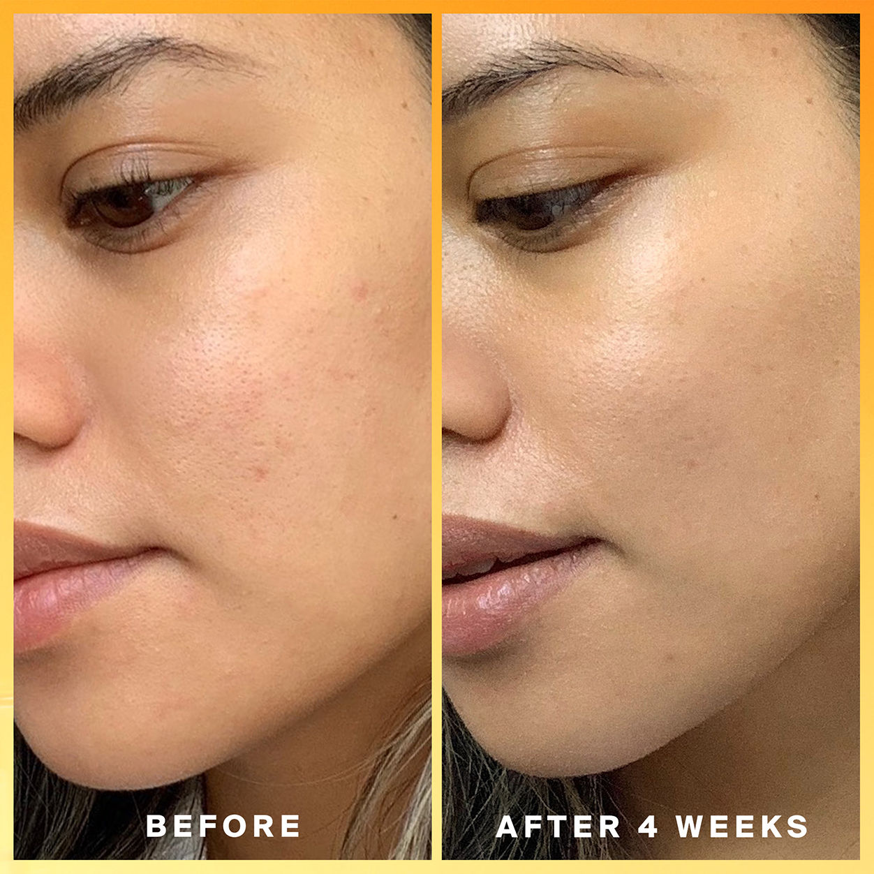 Before and after results of using Supergoop! Daily Dose Vitamin C SPF 40