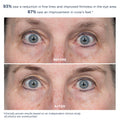 Before and after results of using M-61 ProSmooth Retinol Eye Serum