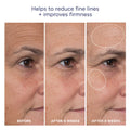 M-61 Advanced Essentials Four Step Skincare System before and after image .