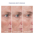 M-61 Advanced Essentials Four Step Skincare System before and after image 3 .