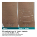 Before and after results of using M-61 ProSculpt Contour Body Cream