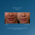 Before and after results of using IS Clinical Daily Dynamic Hydrator