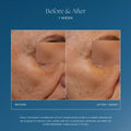 Before and after results of using IS Clinical Daily Dynamic Hydrator