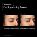 PCA Skin Vitamin B3 Eye Brightening Cream before and after image .