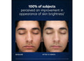 Before and after results of using PCA Skin HydraBright Moisturizer
