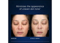 Before and after results of using PCA Skin HydraBright Moisturizer