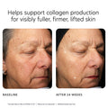 Before and after results of using PCA Skin MGF Age Renewal Cream