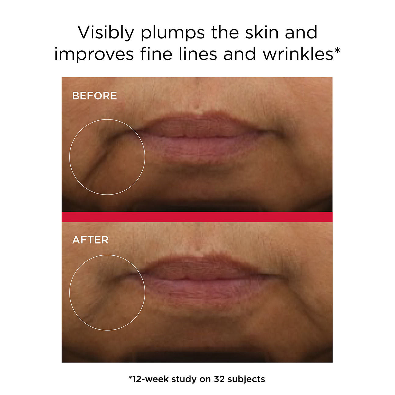 Before and after results of using EltaMD UV Daily Hydration+ Broad Spectrum SPF 50